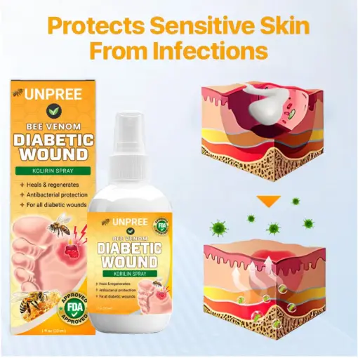 UNPREE™ Bee Venom Diabetic Wound Kolirin Spray