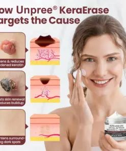 Unpree® KeraErase Dual-Action Renewal Cream