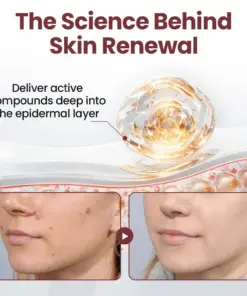 Unpree® KeraErase Dual-Action Renewal Cream